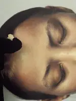 Helnwein works on "Head of a Child 5" Helnwein works on "Head of a Child 5"