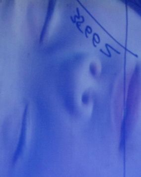 Der Himmel voller Kinderleichen