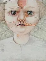 Otorhinolaryngological aspects of handicapped children in visual arts Otorhinolaryngological aspects of handicapped children in visual arts