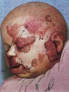 R. Höpfinger and E. Regnier hand out sweets and toys bearing texts and Helnwein pictures of wounded children to passers-by in Zürich.