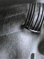 Electroshock Electroshock