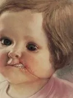 Bambini trafitti da Helnwein Bambini trafitti da Helnwein